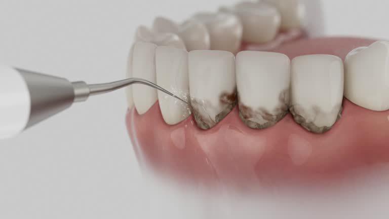Reliable Dental Implants contractor in Muscoy, CA by Smile Center Dentistry